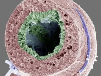 The fruit flies’ kidneys magnified 3000 times. Microvilli on the inside of the flues kidneys are shown in green. (Illustration: © Kenneth A. Halberg 2016) The fruit flies’ kidneys magnified 3000 times. Microvilli on the inside of the flues kidneys are shown in green. (Illustration: © Kenneth A. Halberg 2016)