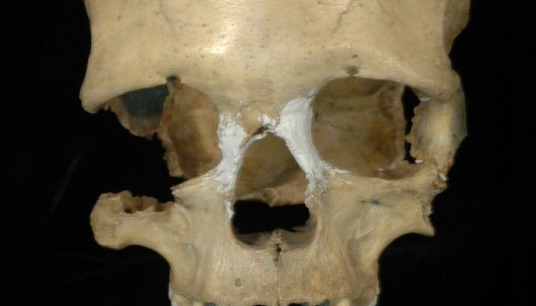 DNA analysis of a 35,000 year-old skull suggests that early Eurasian hunter-gatherers migrated back to Africa, some 45,000 years ago. The skull was that of a Stone Age woman found in Pestera Muierii cave in Romania in 1952. (Photo: E. Trinkaus and A. Soficaru) DNA analysis of a 35,000 year-old skull suggests that early Eurasian hunter-gatherers migrated back to Africa, some 45,000 years ago. The skull was that of a Stone Age woman found in Pestera Muierii cave in Romania in 1952. (Photo: E. Trinkaus and A. Soficaru)