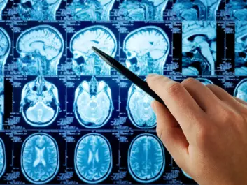 Case-control studies indicate a causal link between brain cancer and mobile phone radiation, but so far there has not been a boom in mobile-phone related cancer in the general public despite the widespread use of the technology. (Photo: Shutterstock)