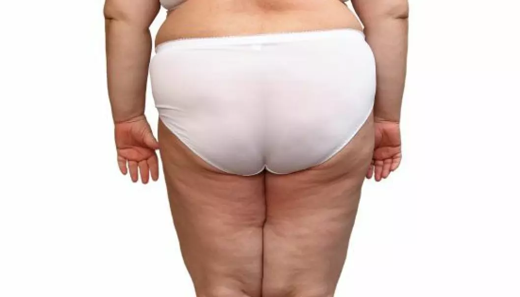 Fat on the hips and thighs is not unhealthy – it helps you live longer. (Photo: Mik122)