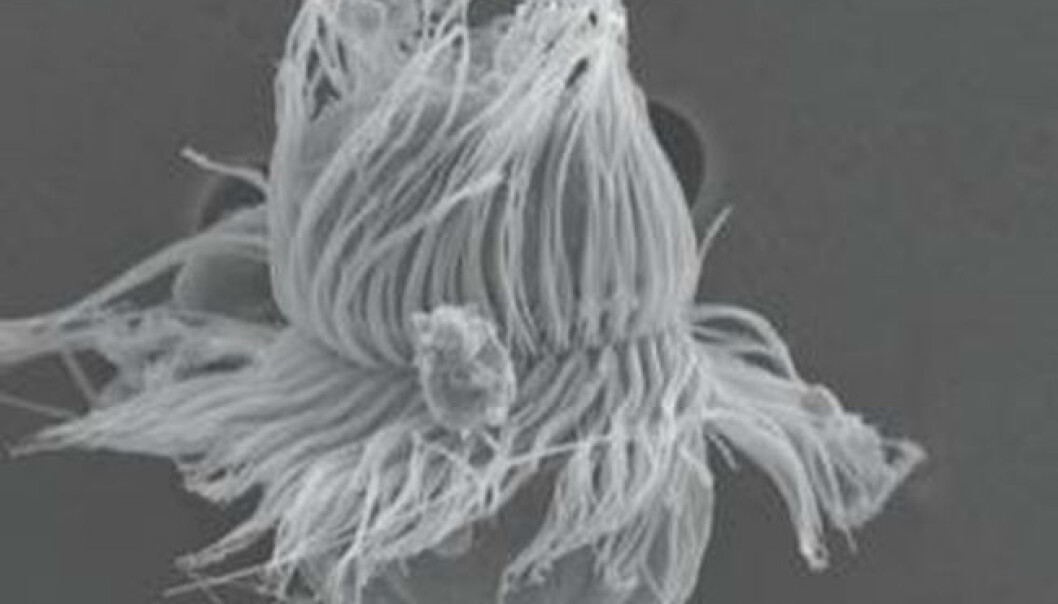 Mesodinium chamaeleon is neither plant nor animal. Using its hundreds of small hairs, it can move rapidly through water, finding plants to eat – after which it changes into a plant. (Photo: Øjvind Moestrup/Journal of Eukaryotic Microbiology) Mesodinium chamaeleon is neither plant nor animal. Using its hundreds of small hairs, it can move rapidly through water, finding plants to eat – after which it changes into a plant. (Photo: Øjvind Moestrup/Journal of Eukaryotic Microbiology)