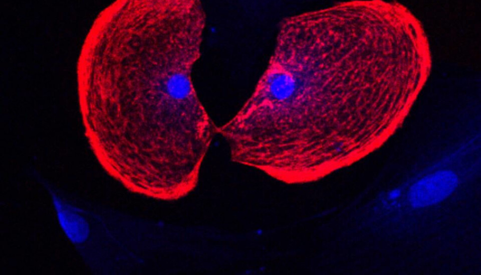 Gold went to this photo called “The Kiss,” depicting stem cell-derived cardiomyocytes (Zoe Andersen-Jenkins)