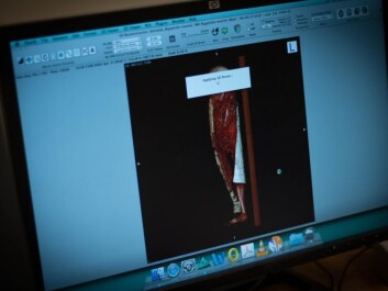 The first 3D images appear on-screen during the scans. These will later be used to create a 3D model of the mummies. (Photo: Kirstine Jacobsen / ScienceNordic) The first 3D images appear on-screen during the scans. These will later be used to create a 3D model of the mummies. (Photo: Kirstine Jacobsen / ScienceNordic)