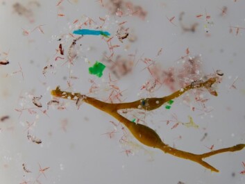 A piece of plankton surrounded by small pieces of plastic (microplastic) collected in the Arctic ocean. (Photo: Anna Deniaud) A piece of plankton surrounded by small pieces of plastic (microplastic) collected in the Arctic ocean. (Photo: Anna Deniaud)