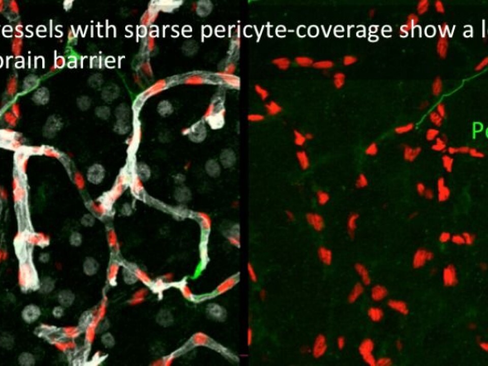 Betsholtz and colleagues ascertained that capillaries which partly lack pericytes turned out to have a blood-brain barrier that leaked. (Photo: Dr Maarja Andaloussi Mäe)