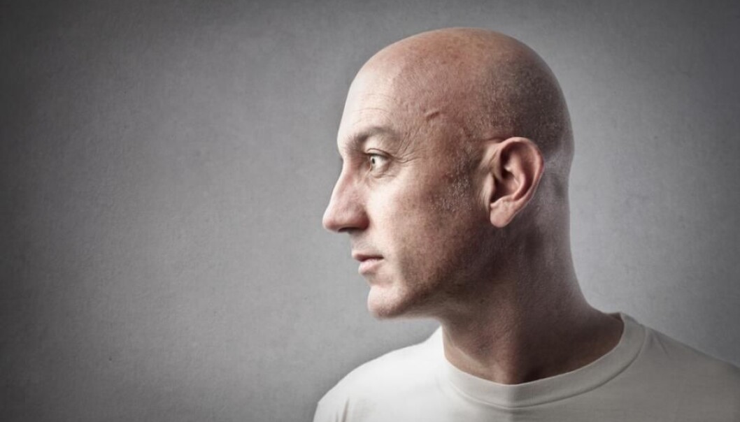 Chemotherapy could lead to memory impairment and concentration difficulties following treatment. These are the findings of a study of 64 men treated for testicular cancer in Denmark. (Photo: Shutterstock) Chemotherapy could lead to memory impairment and concentration difficulties following treatment. These are the findings of a study of 64 men treated for testicular cancer in Denmark. (Photo: Shutterstock)