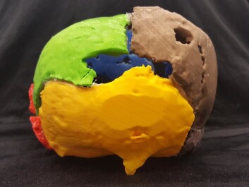 A 3D print of Gorm the Old’s cranium, seen from behind. The unusual growth is illustrated in yellow. (Photo: Marie Louise Jørkov) A 3D print of Gorm the Old’s cranium, seen from behind. The unusual growth is illustrated in yellow. (Photo: Marie Louise Jørkov)