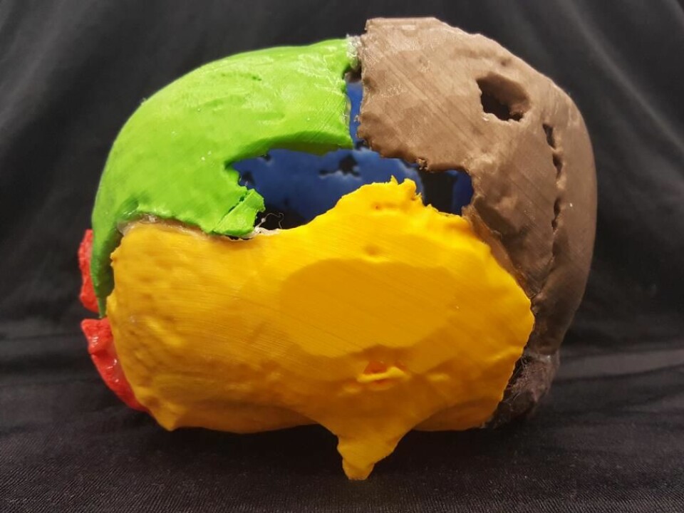 A 3D print of Gorm the Old’s cranium, seen from behind. The unusual growth is illustrated in yellow. (Photo: Marie Louise Jørkov)