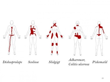 How pain looks according to one body diagram from CNAP. (Photo: Shellie A. Bourdreau) How pain looks according to one body diagram from CNAP. (Photo: Shellie A. Bourdreau)