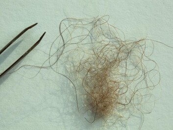 A hair sample allegedly from a Yeti in Nepal. (Photo: Icon Films Ltd.) A hair sample allegedly from a Yeti in Nepal. (Photo: Icon Films Ltd.)