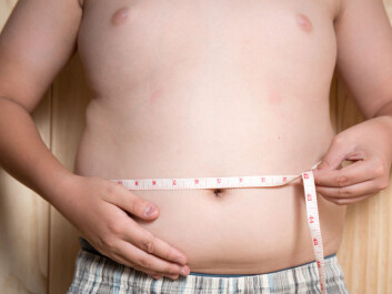 Caesarean section is associated with an increased risk of obesity in the child. (Photo: Shutterstock) Caesarean section is associated with an increased risk of obesity in the child. (Photo: Shutterstock)