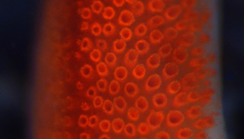 The eye of a Hippasteria phrygiana starfish. (Photo: Marie Helene Birk)