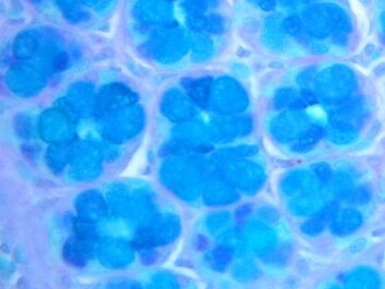 The intestinal cells of the colon is covered by a protective mucus layer, which some bacteria use as food. Under the microscope, this mucus layer look like small flowers. (Photo: Author provided) The intestinal cells of the colon is covered by a protective mucus layer, which some bacteria use as food. Under the microscope, this mucus layer look like small flowers. (Photo: Author provided)