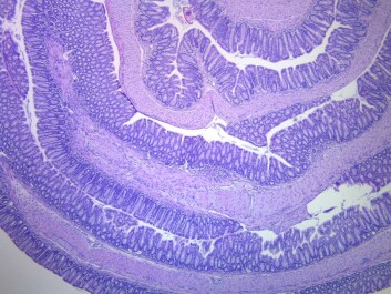 The colon, here seen from within, contains more than 10,000,000,000,000 cells per gram of intestinal content and between 300 to 1000 different bacterial species. (Photo: Author provided) The colon, here seen from within, contains more than 10,000,000,000,000 cells per gram of intestinal content and between 300 to 1000 different bacterial species. (Photo: Author provided)