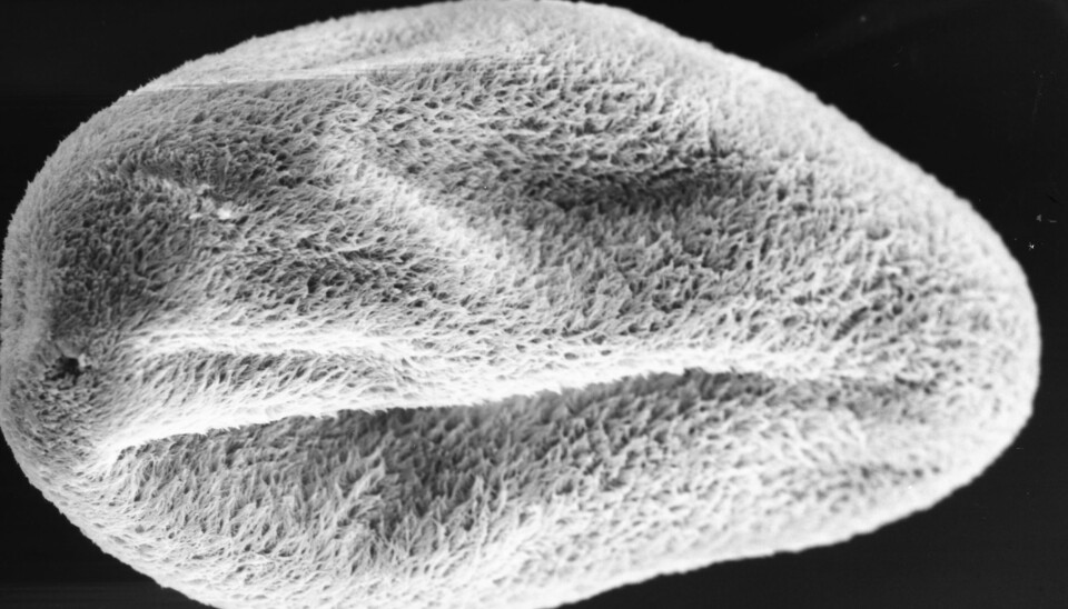 The parasite as seen under an electron microscope. (Photo: Kurt Buchmann)