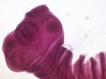 A pork tapeworm, magnified 40 times. (Photo: Roberto J. Galindo) A pork tapeworm, magnified 40 times. (Photo: Roberto J. Galindo)