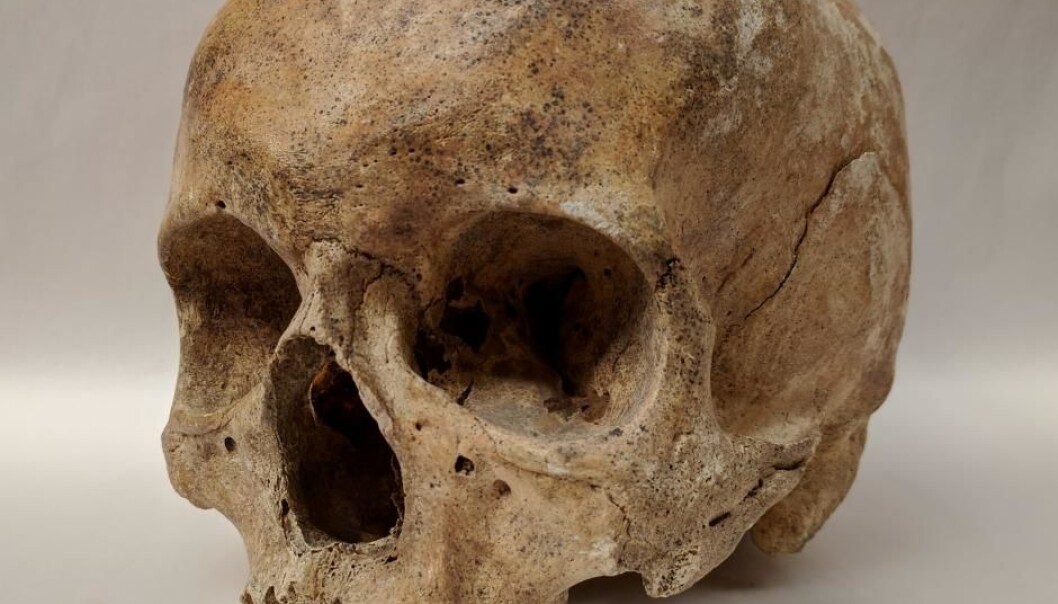 Skeletons from a leprosy hospital in Odense, Denmark. Even after being buried for 700 years, scientists can still find traces of leprosy bacteria in the old bones. (Photo: Dorthe Pedersen) Skeletons from a leprosy hospital in Odense, Denmark. Even after being buried for 700 years, scientists can still find traces of leprosy bacteria in the old bones. (Photo: Dorthe Pedersen)