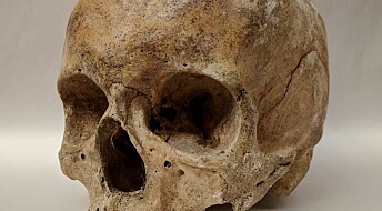Leprosy DNA extracted from medieval skeletons in Denmark
