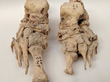 In the new study, scientists have studied DNA from bones of 69 skeletons from the Middle Ages, which were compared with DNA from 152 skeletons randomly selected from the same period. (Photo: Dorthe Pedersen) In the new study, scientists have studied DNA from bones of 69 skeletons from the Middle Ages, which were compared with DNA from 152 skeletons randomly selected from the same period. (Photo: Dorthe Pedersen)