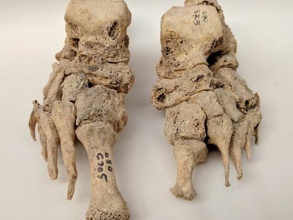 In the new study, scientists have studied DNA from bones of 69 skeletons from the Middle Ages, which were compared with DNA from 152 skeletons randomly selected from the same period. (Photo: Dorthe Pedersen)