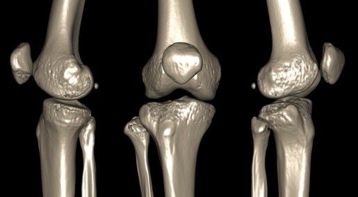 Considering knee surgery? Read this first