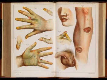 Accidents caused by the use of green arsenic, 1859. (Image: Wellcome Collection, CC BY-SA) Accidents caused by the use of green arsenic, 1859. (Image: Wellcome Collection, CC BY-SA)