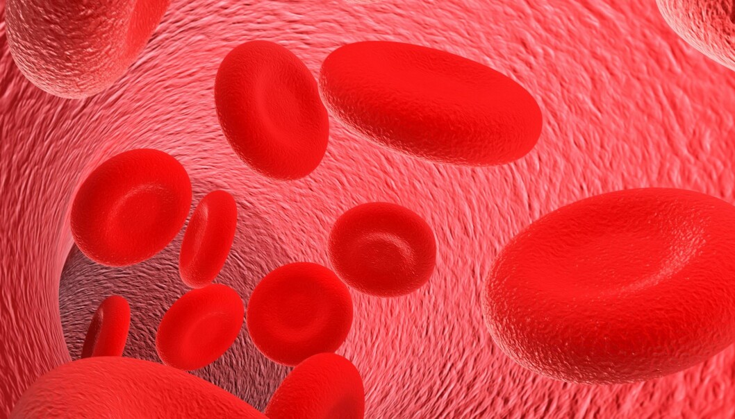 Blood cells have deformed cores in patients with CDAI, resulting in problems in cell division. (Photo: Colourbox)