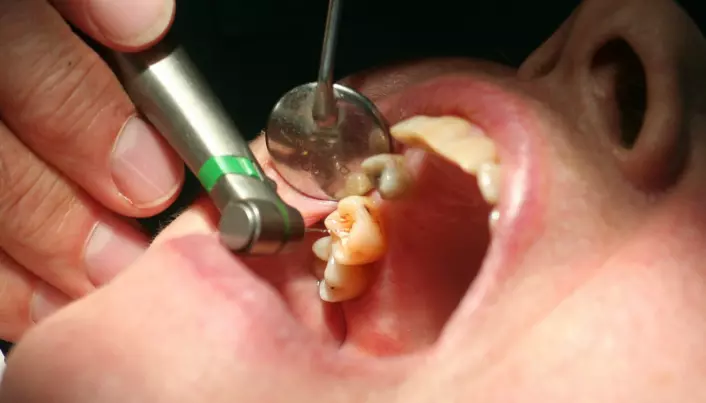 Why don’t teeth heal themselves?