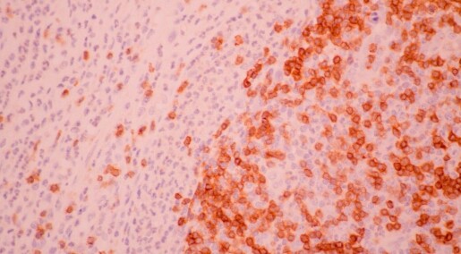 Written in the blood: Researchers detect signs of cancer risk years in advance of disease Written in the blood: Researchers detect signs of cancer risk years in advance of disease