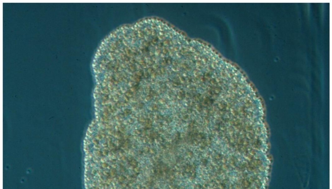 Trichoplax adhaerens, despite the lack of a nervous system, is able to perform quite complex behaviours – relatively speaking. Trichoplax adhaerens, despite the lack of a nervous system, is able to perform quite complex behaviours – relatively speaking.