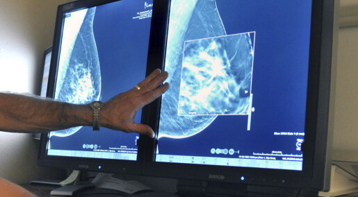 Norwegian researchers are developing a new method for detecting breast cancer