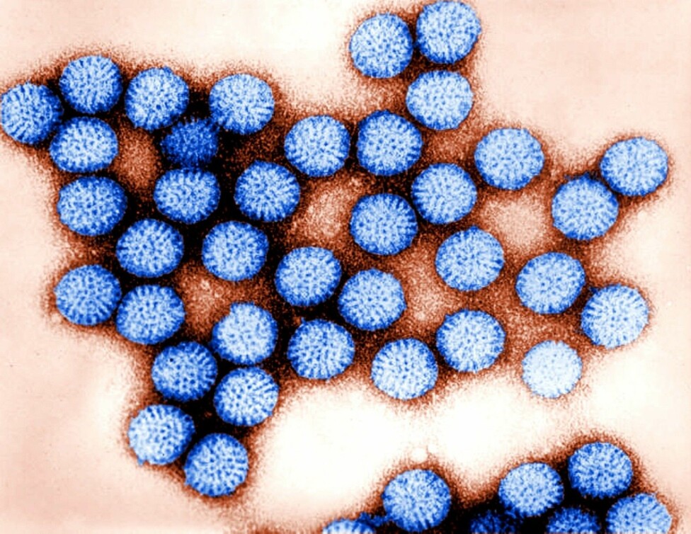Figure 3. Rota virus particles (blue) seen through an electron microscope.