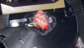 The image shows a biopsy from the cerebellum, an area of the brain with many folds. There is not a lot of white matter in this piece – therefore it looks different from the first photo. The piece is glued down and sitting in a solution that is similar to the solution your brain is normally floating in. The blade is just about to cut a slice of the tissue sample – if you look closely, you can see the slices that have already been cut lying at the edges of the image. The image shows a biopsy from the cerebellum, an area of the brain with many folds. There is not a lot of white matter in this piece – therefore it looks different from the first photo. The piece is glued down and sitting in a solution that is similar to the solution your brain is normally floating in. The blade is just about to cut a slice of the tissue sample – if you look closely, you can see the slices that have already been cut lying at the edges of the image.