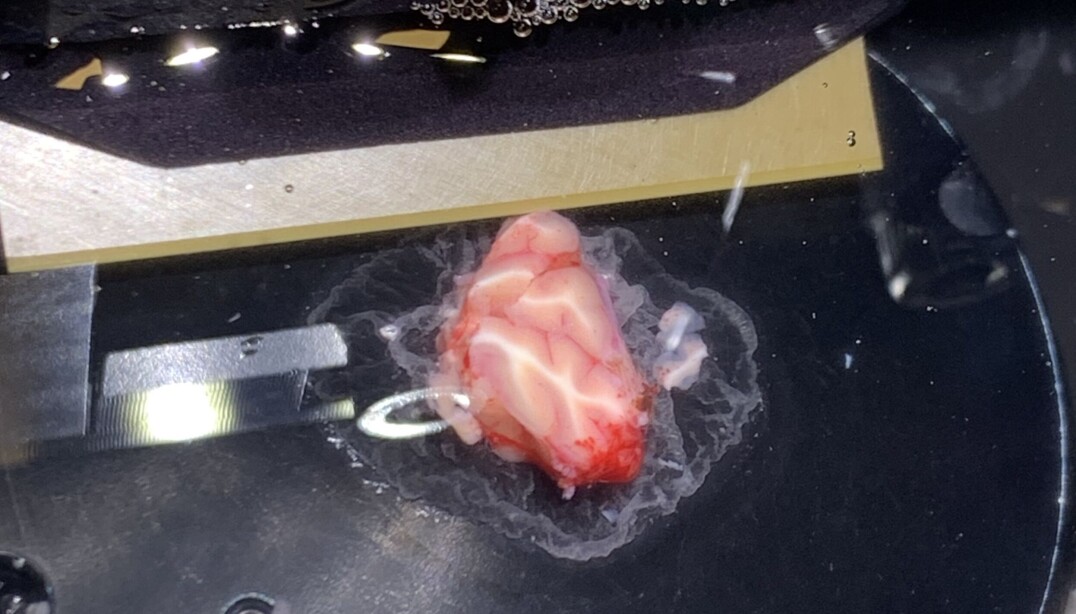Emma Louth uses living brain tissue from humans in her research to better understand how the brain works. Emma Louth uses living brain tissue from humans in her research to better understand how the brain works.
