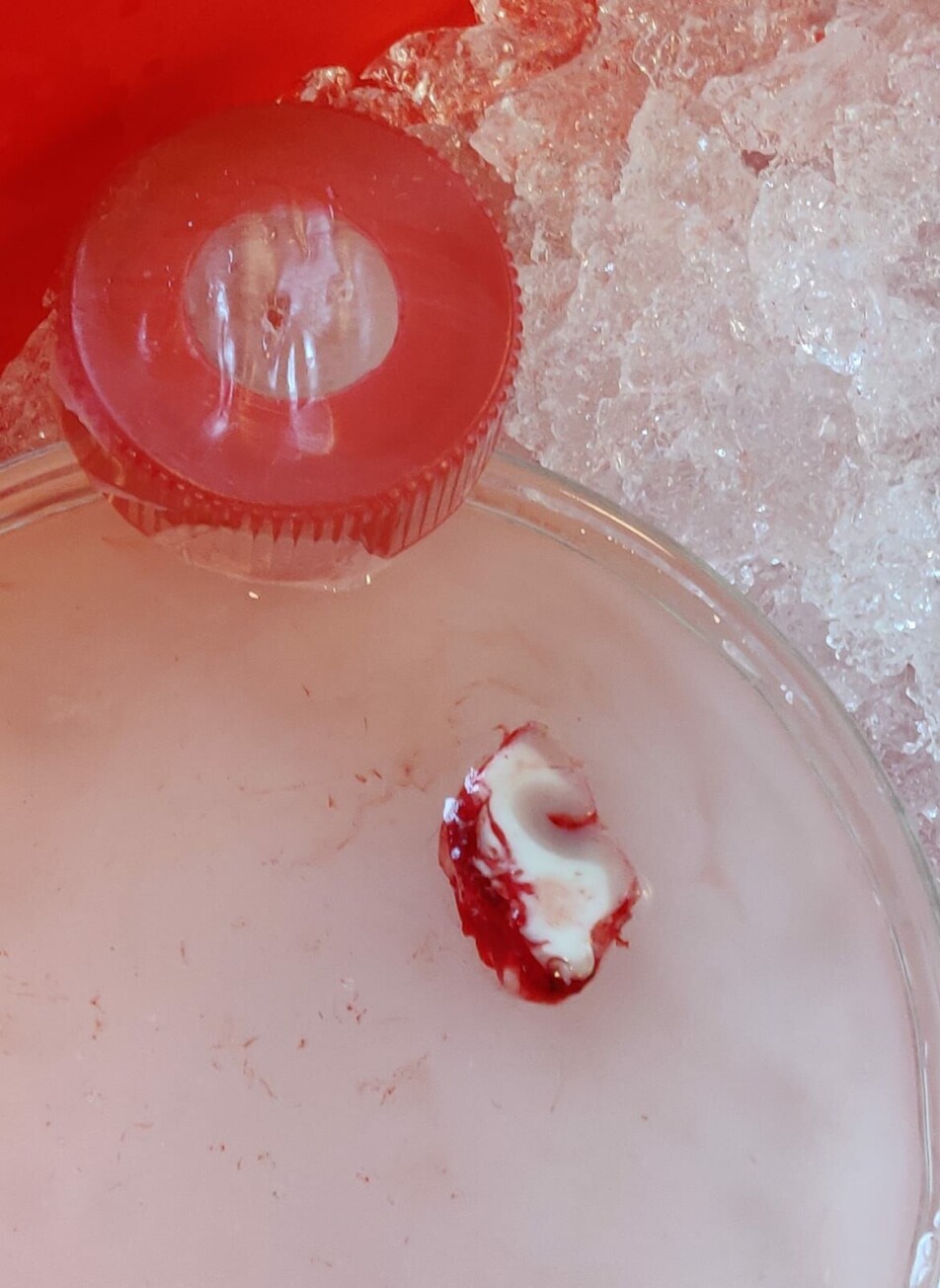 The image shows a small tissue sample from the cortex. The piece is approximately 1 cm on the longest side. The red part is blood, while the while part of the piece is what is referred to as white matter. The pink area is the grey matter. It is in the grey matter that we use for research.