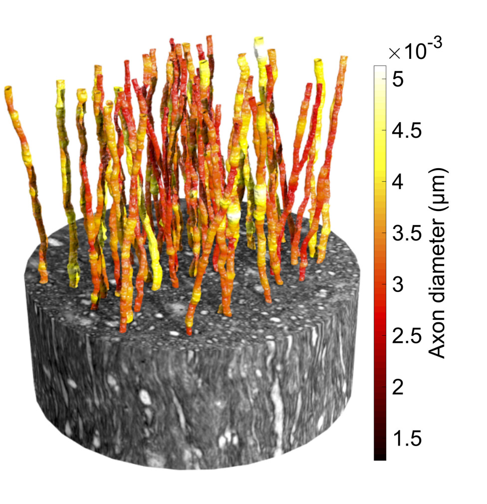 Large axons with different diameters (see colour bar) within a 3D image of brain tissue from a monkey brain.