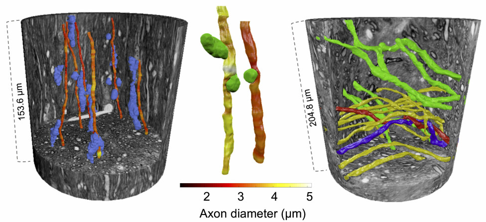 Left: Cells (in blue) push the axons and change their paths. Middle: blob-like vacuoles (green), whose purpose is unknown, could also be found in the tissue and affected the diameter of axons. Right: Axons travelling in different directions (represented by the green/yellow colours) in another region of the monkey brain. Two axons could even be seen to twist around each other (in red and blue).