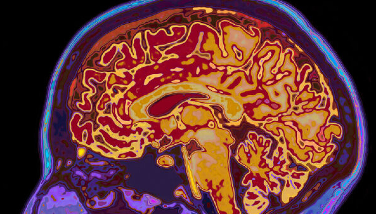 Spaghetti Brain The brain acts like boiled spaghetti - a trait that can help us better ...