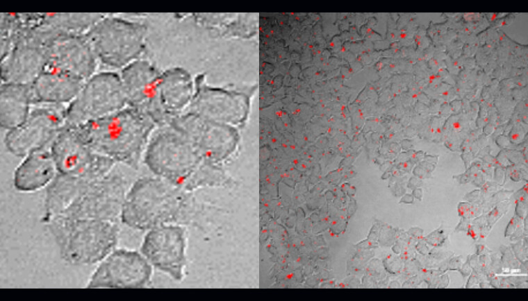 The red light shows RNA molecules inside living cells. The light makes it possible to follow the molecules' behaviour. glowing rna