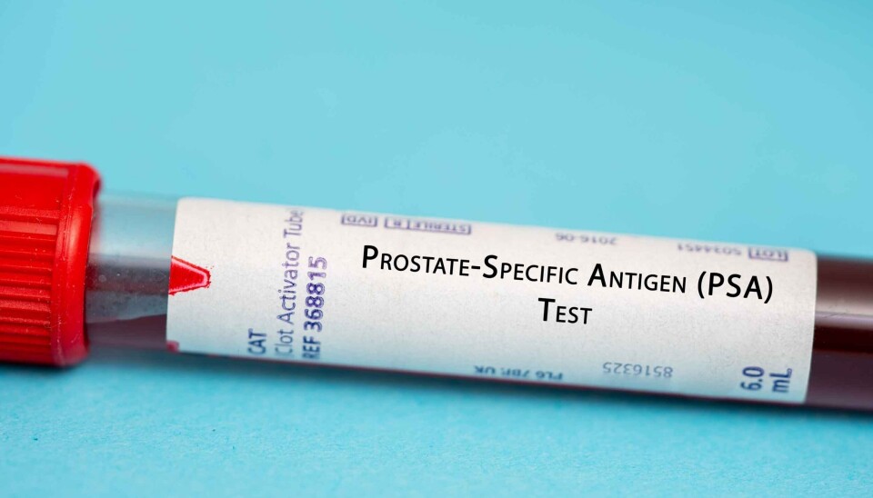 The most widely used screening method for prostate cancer today is a blood test that measures the level of a protein called PSA (prostate-specific antigen). PSA is produced by prostate cells and plays a role in the production of sperm.