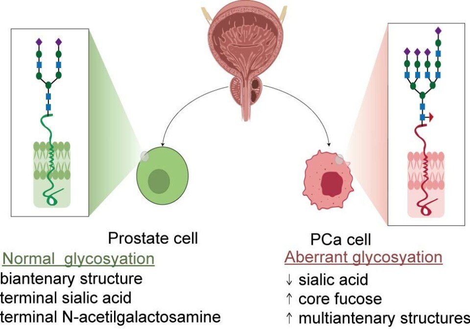 While the cell membrane is fine and smooth on the healthy cell, it is uneven on the cancerous cell. The surface of the cell is lined with sugars, which are affected by the cancer. (Illustration: Díaz-Fernández et al., 2024)