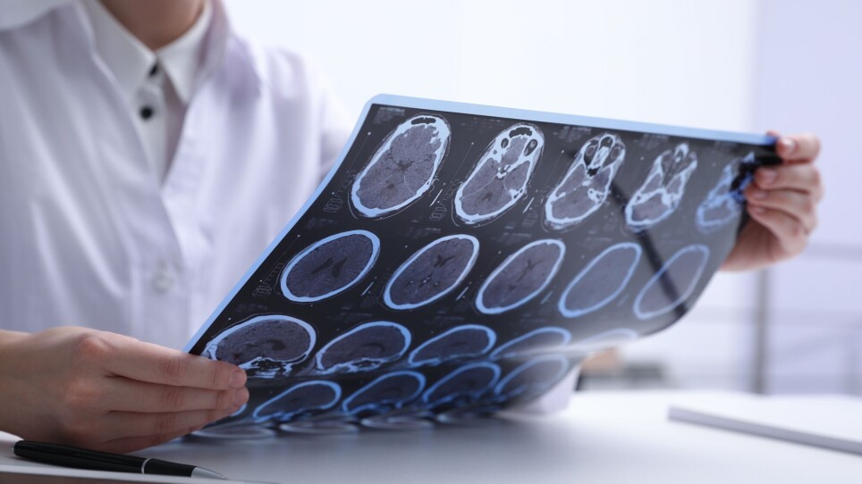 Researchers want to find out if viruses are behind diseases in the brain