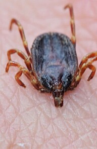 Ticks can spread more than just Lyme disease and TBE virus